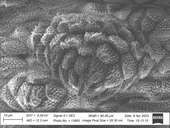 Media type: image;   Invertebrate Zoology 32029 Description: SEM image of specimen.;  Aspect: ventral